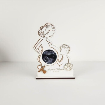 Kişiye Özel Baskılı Ultrason Resim Çerçevesi Model 2