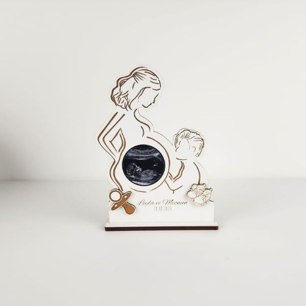 Kişiye Özel Baskılı Ultrason Resim Çerçevesi Model 2 - Görsel 1