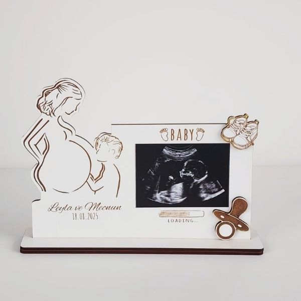 Kişiye Özel Baskılı Ultrason Resim Çerçevesi - Görsel 1